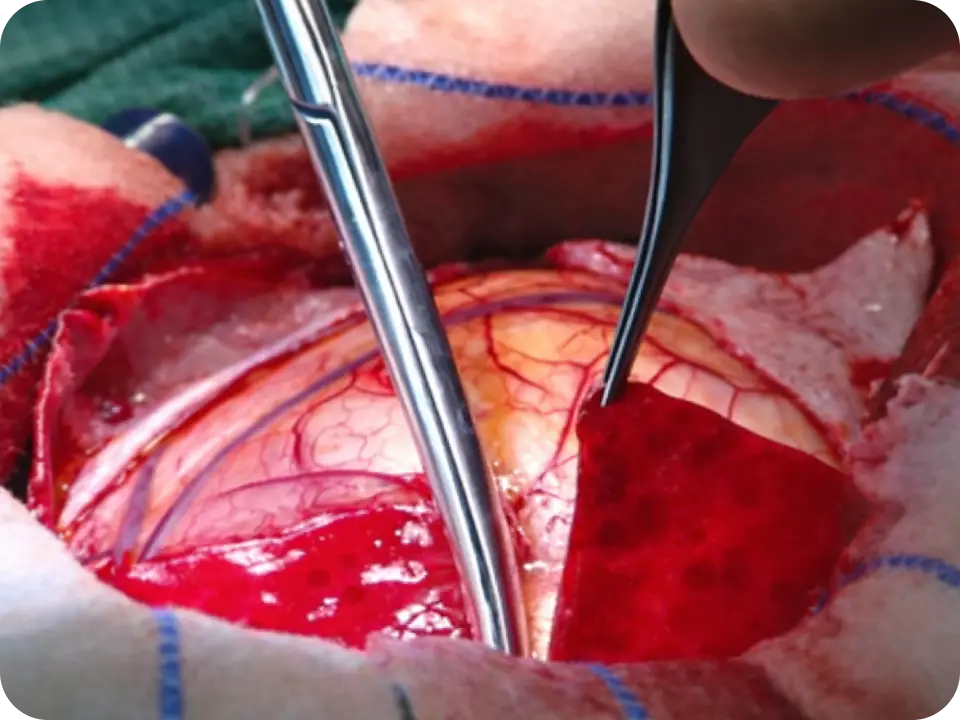 Surgeon preparing surgical site.